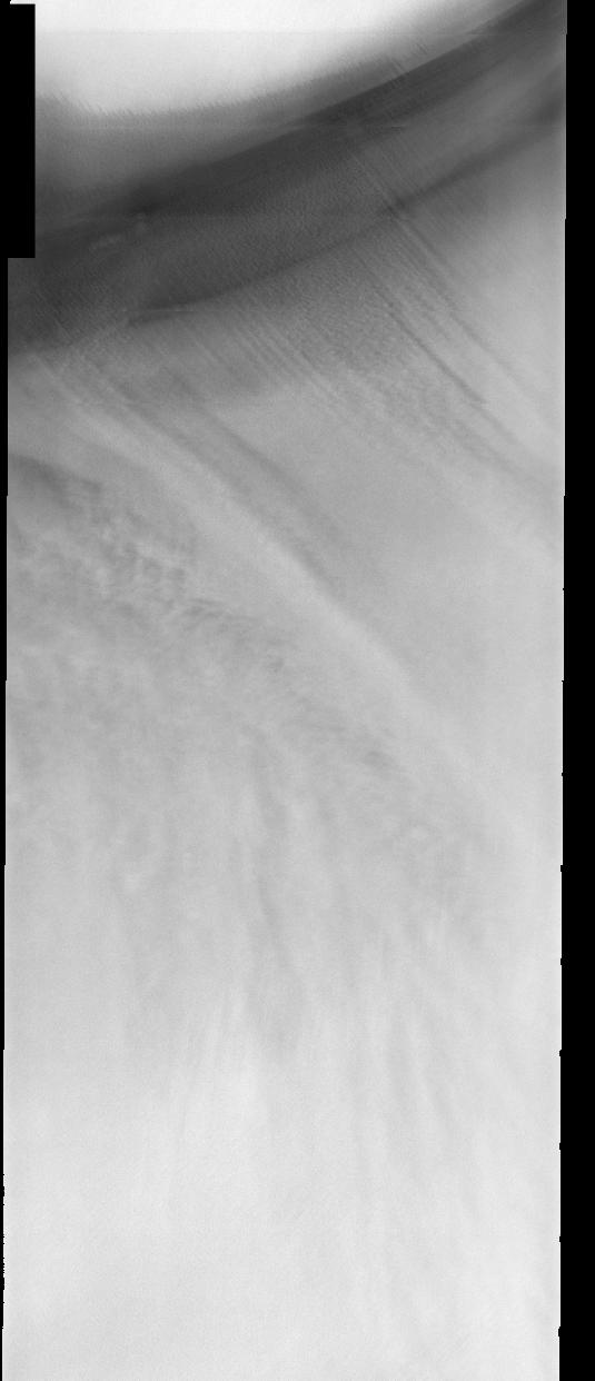 North Polar Cap