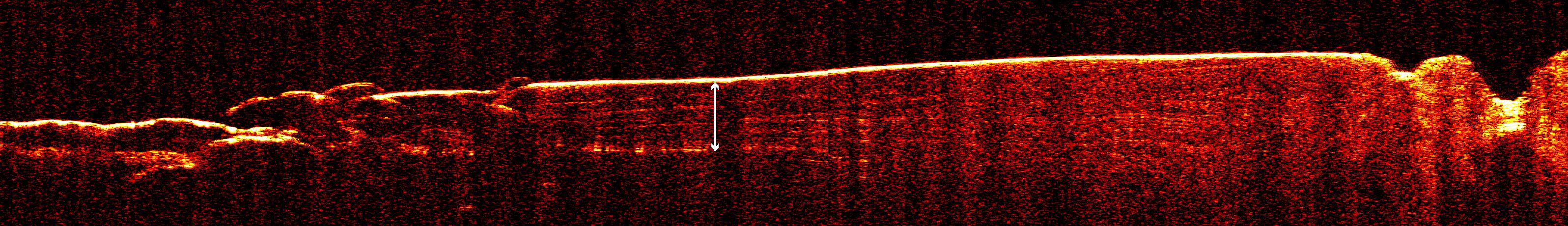 Radar View of Layering near Mars South Pole, Orbit 1360