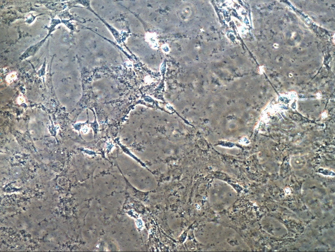 Skeletal muscle cells cultured in space
