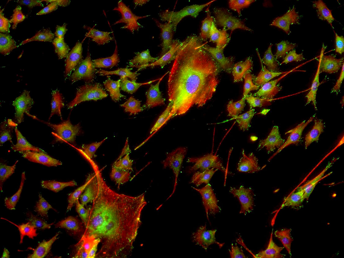 Skeletal muscle cells cultured on Earth