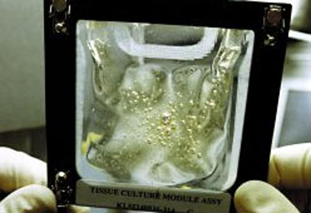 During the STS-90 shuttle flight in April 1998, cultured renal cortical cells revealed new information about genes. Timothy Hammond, an investigator in NASA's microgravity biotechnology program was interested in culturing kidney tissue to study the expression of proteins useful in the treatment of kidney diseases. Protein expression is linked to the level of differentiation of the kidney cells, and Hammond had difficulty maintaining differentiated cells in vitro. Intrigued by the improvement in cell differentiation that he observed in rat renal cells cultured in NASA's rotating wall vessel (a bioreactor that simulates some aspects of microgravity) and during an experiment performed on the Russian Space Station Mir, Hammond decided to sleuth out which genes were responsible for controlling differentiation of kidney cells. To do this, he compared the gene activity of human renal cells in a variety of gravitational environments, including the microgravity of the space shuttle and the high-gravity environment of a centrifuge. Hammond found that 1,632 genes out of 10,000 analyzed changed their activity level in microgravity, more than in any of the other environments. These results have important implications for kidney research as well as for understanding the basic mechanism for controlling cell differentiation.