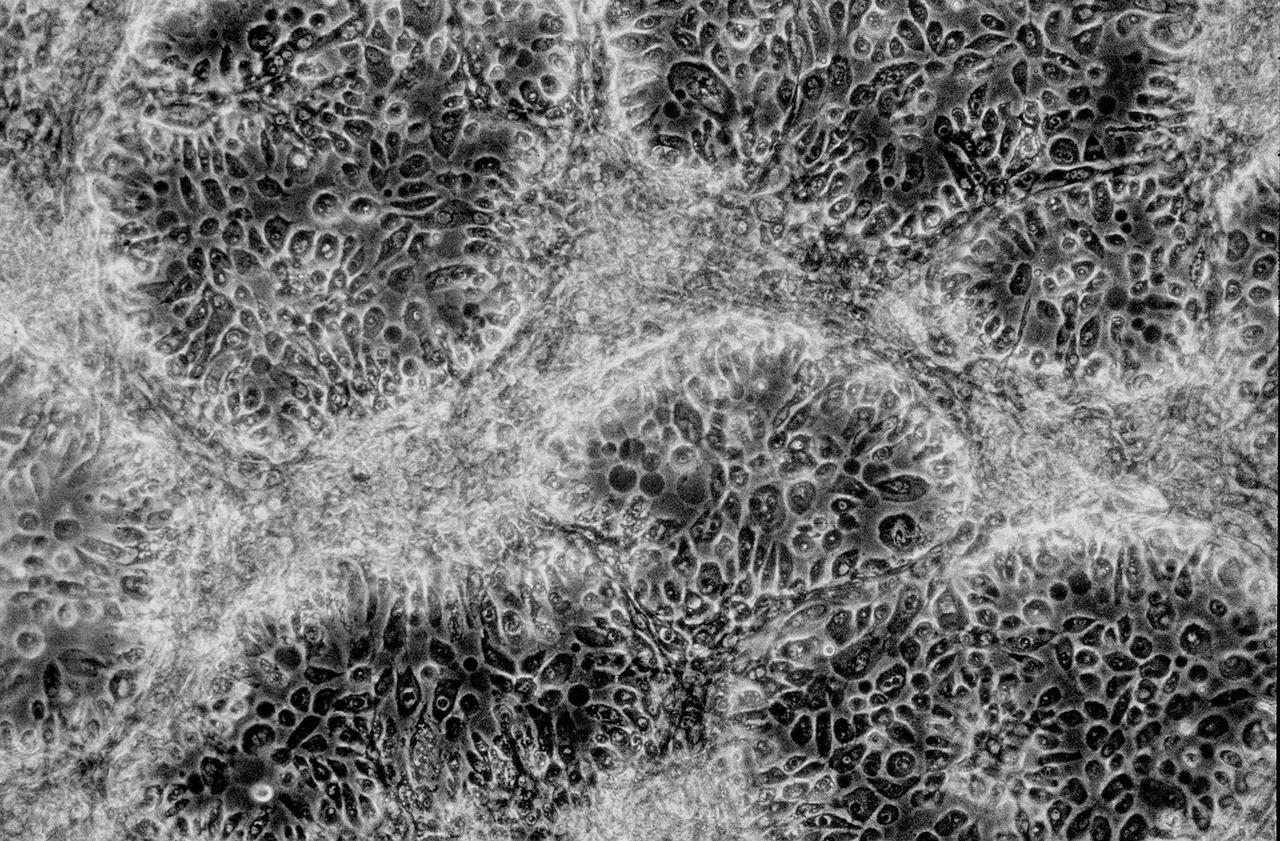 Isolation of human mammary epithelial cells (HMEC) from breast cancer susceptible tissue. Outgrowth of cells from duct element in upper right corner cultured in a standard dish; most cells spontaneously die during early cell divisions, but a few will establish long-term growth. NASA's Marshall Space Flight Center (MSFC) is sponsoring research with Bioreactors, rotating wall vessels designed to grow tissue samples in space, to understand how breast cancer works. This ground-based work studies the growth and assembly of human mammary epithelial cell (HMEC) from breast cancer susceptible tissue. Radiation can make the cells cancerous, thus allowing better comparisons of healthy vs. tunorous tissue. Credit: Dr. Robert Tichmond, NASA/Marshall Space Flight Center (MSFC).