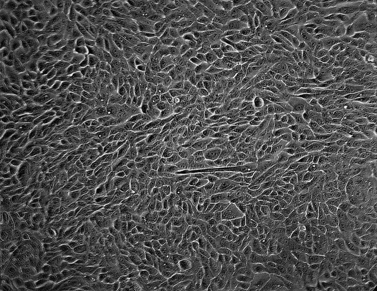 Isolation of human mammary epithelial cells (HMEC) from breast cancer susceptible tissue. Isolate of long-term growth human mammary epithelial cells (HMEC) from outgrowth of duct element; cells shown soon after isolation and early in culture in a dish. NASA's Marshall Space Flight Center (MSFC) is sponsoring research with Bioreactors, rotating wall vessels designed to grow tissue samples in space, to understand how breast cancer works. This ground-based work studies the growth and assembly of human mammary epithelial cell (HMEC) from breast cancer susceptible tissue. Radiation can make the cells cancerous, thus allowing better comparisons of healthy vs. tunorous tissue. Credit: Dr. Robert Tichmond, NASA/Marshall Space Flight Center (MSFC).