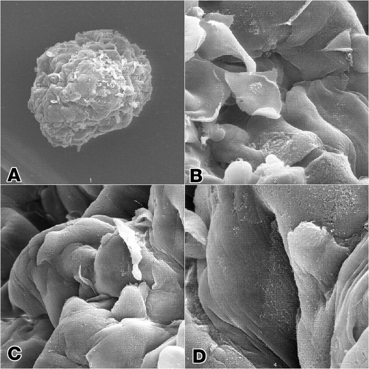 Epithelial and fibroblast cell coculture: Long-term growth human mammary epithelial cells (HMEC) admixed in coculture with fibroblast from the same initial breast tissue grown as 3-dimenstional constructions in the presence of attachment beads in the NASA Bioreactor. A: A typical constrct about 2.0 mm in diameter without beads on the surface. The center of these constrcts is hollow, and beads are organized about the irner surface. Although the coculture provides smaller constructs than the monoculture, the metabolic of the organized cells is about the same. B, C, D: Closer views of cells showing that the shape of cells and cell-to-cell interactions apprear different in the coculture than in the monoculture constructs. NASA's Marshall Space Flight Center (MSFC) is sponsoring research with Bioreactors, rotating wall vessels designed to grow tissue samples in space, to understand how breast cancer works. This ground-based work studies the growth and assembly of human mammary epithelial cell (HMEC) from breast cancer susceptible tissue. Radiation can make the cells cancerous, thus allowing better comparisons of healthy vs. tunorous tissue. Credit: Dr. Robert Richmond, NASA/Marshall Space Flight Center (MSFC).