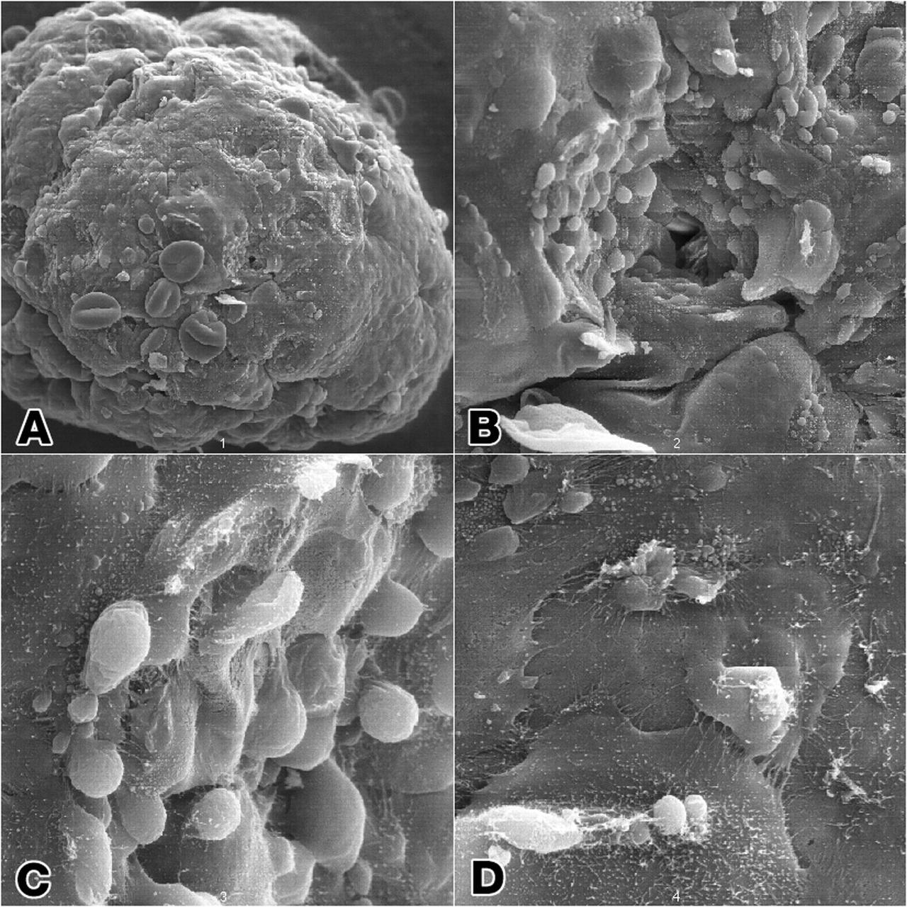 Epithelial cell monoculture: Long-term growth of human mammary epithelial cells (HMEC) grown in monoculture as 3-dimensional constructions in the presence of attachment beads in the NASA Bioreactor. A: A typical construct about 3.5 mm (less than 1/8th inch) in diameter with slightly dehydrted, crinkled beads contained on the surface as well as within the 3-dimensional structure. B: The center of these constructs is hollow. Crinkling of the beads causes a few to fall out, leaving crater-like impressiions in the construct. The central impression shows a small hole that accesses the hollow center of the construct. C: A closeup view of the cells and the hole the central impression. D: Closer views of cells in the construct showing sell-to-cell interactions. NASA's Marshall Space Flight Center (MSFC) is sponsoring research with Bioreactors, rotating wall vessels designed to grow tissue samples in space, to understand how breast cancer works. This ground-based work studies the growth and assembly of human mammary epithelial cell (HMEC) from breast cancer susceptible tissue. Radiation can make the cells cancerous, thus allowing better comparisons of healthy vs. tunorous tissue. Credit: Dr. Robert Richmond, NASA/Marshall Space Flight Center (MSFC).