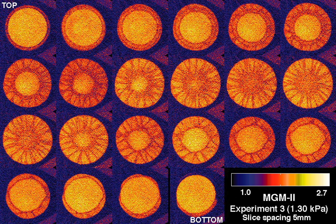 CT scans of the spcimens on STS-79 reveal internal cone-shaped features and radial patterns not seen in specimens processed on the ground. The lighter areas are the densest in these images. CT scans produced richly detailed images allowing scientists to build 3D models of the interior of the specimens that can be compared with microscopic examination of thin slices. This view depict horizontal slices from top to bottom of a flight specimen. Sand and soil grains have faces that can cause friction as they roll and slide against each other, or even cause sticking and form small voids between grains. This complex behavior can cause soil to behave like a liquid under certain conditions such as earthquakes or when powders are handled in industrial processes. Mechanics of Granular Materials (MGM) experiments aboard the Space Shuttle use the microgravity of space to simulate this behavior under conditions that carnot be achieved in laboratory tests on Earth. MGM is shedding light on the behavior of fine-grain materials under low effective stresses. Applications include earthquake engineering, granular flow technologies (such as powder feed systems for pharmaceuticals and fertilizers), and terrestrial and planetary geology. Nine MGM specimens have flown on two Space Shuttle flights. Another three are scheduled to fly on STS-107. The principal investigator is Stein Sture of the University of Colorado at Boulder. Credit: Los Alamos National Laboratory and the University of Colorado at Boulder.