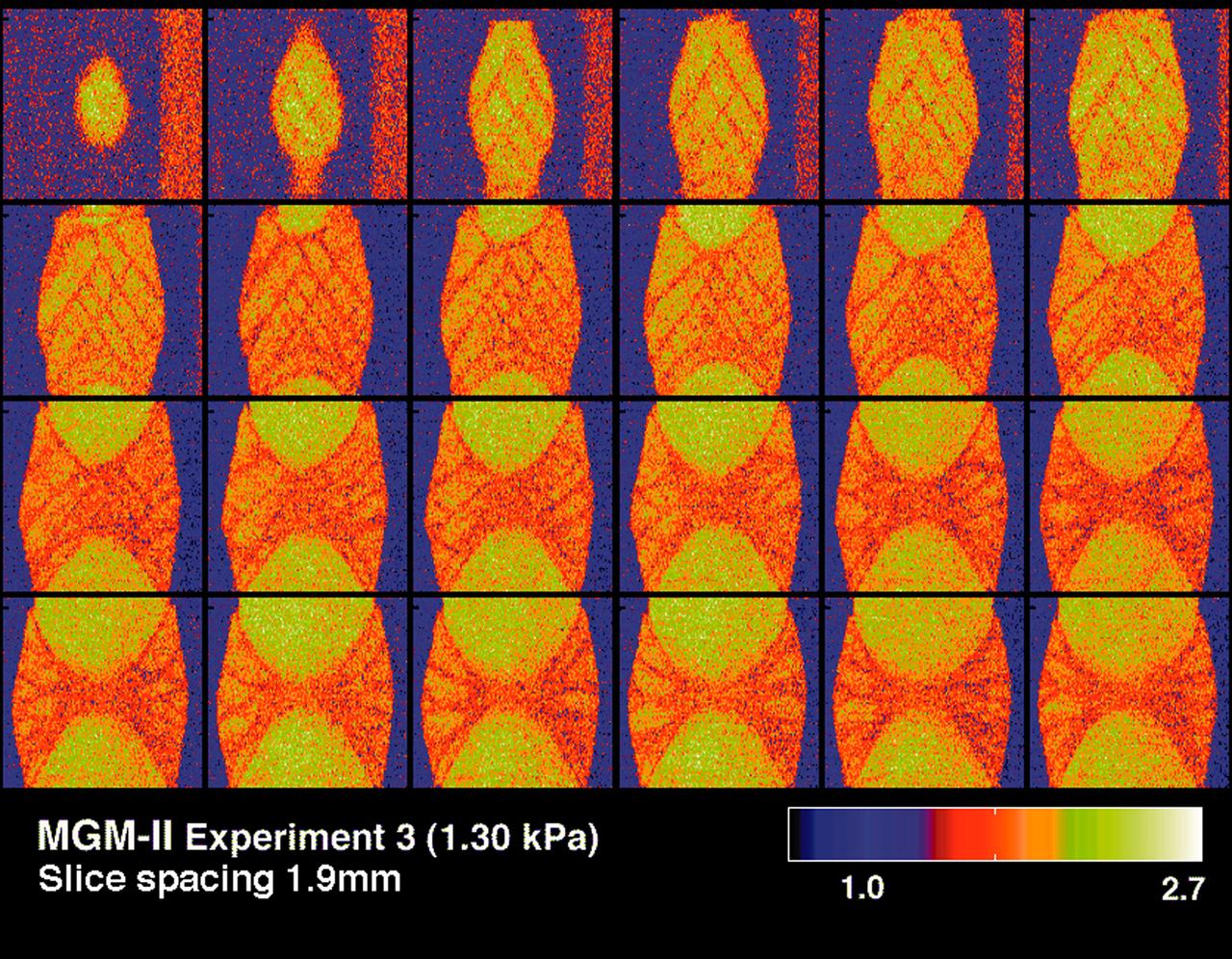 CT scans of the spcimens on STS-79 reveal internal cone-shaped features and radial patterns not seen in specimens processed on the ground. The lighter areas are the densest in these images. CT scans produced richly detailed images allowing scientists to build 3D models of the interior of the specimens that can be compared with microscopic examination of thin slices. These views depict vertical slices from side to middle of a flight specimen. Sand and soil grains have faces that can cause friction as they roll and slide against each other, or even cause sticking and form small voids between grains. This complex behavior can cause soil to behave like a liquid under certain conditions such as earthquakes or when powders are handled in industrial processes. Mechanics of Granular Materials (MGM) experiments aboard the Space Shuttle use the microgravity of space to simulate this behavior under conditions that carnot be achieved in laboratory tests on Earth. MGM is shedding light on the behavior of fine-grain materials under low effective stresses. Applications include earthquake engineering, granular flow technologies (such as powder feed systems for pharmaceuticals and fertilizers), and terrestrial and planetary geology. Nine MGM specimens have flown on two Space Shuttle flights. Another three are scheduled to fly on STS-107. The principal investigator is Stein Sture of the University of Colorado at Boulder. Credit: Los Alamos National Laboratory and the University of Colorado at Boulder.