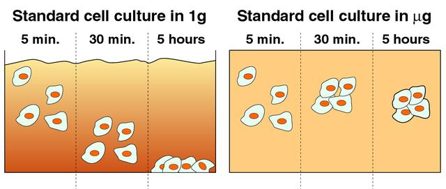 Cells cultured on Earth (left) typically settle quickly on the bottom of culture vessels due to gravity. In microgravity (right), cells remain suspended and aggregate to form three-dimensional tissue. The NASA Bioreactor provides a low turbulence culture environment which promotes the formation of large, three-dimensional cell clusters. The Bioreactor is rotated to provide gentle mixing of fresh and spent nutrient without inducing shear forces that would damage the cells. Due to their high level of cellular organization and specialization, samples constructed in the bioreactor more closely resemble the original tumor or tissue found in the body. The work is sponsored by NASA's Office of Biological and Physical Research. The bioreactor is managed by the Biotechnology Cell Science Program at NASA's Johnson Space Center (JSC). NASA-sponsored bioreactor research has been instrumental in helping scientists to better understand normal and cancerous tissue development. In cooperation with the medical community, the bioreactor design is being used to prepare better models of human colon, prostate, breast and ovarian tumors. Cartilage, bone marrow, heart muscle, skeletal muscle, pancreatic islet cells, liver and kidney are just a few of the normal tissues being cultured in rotating bioreactors by investigators.