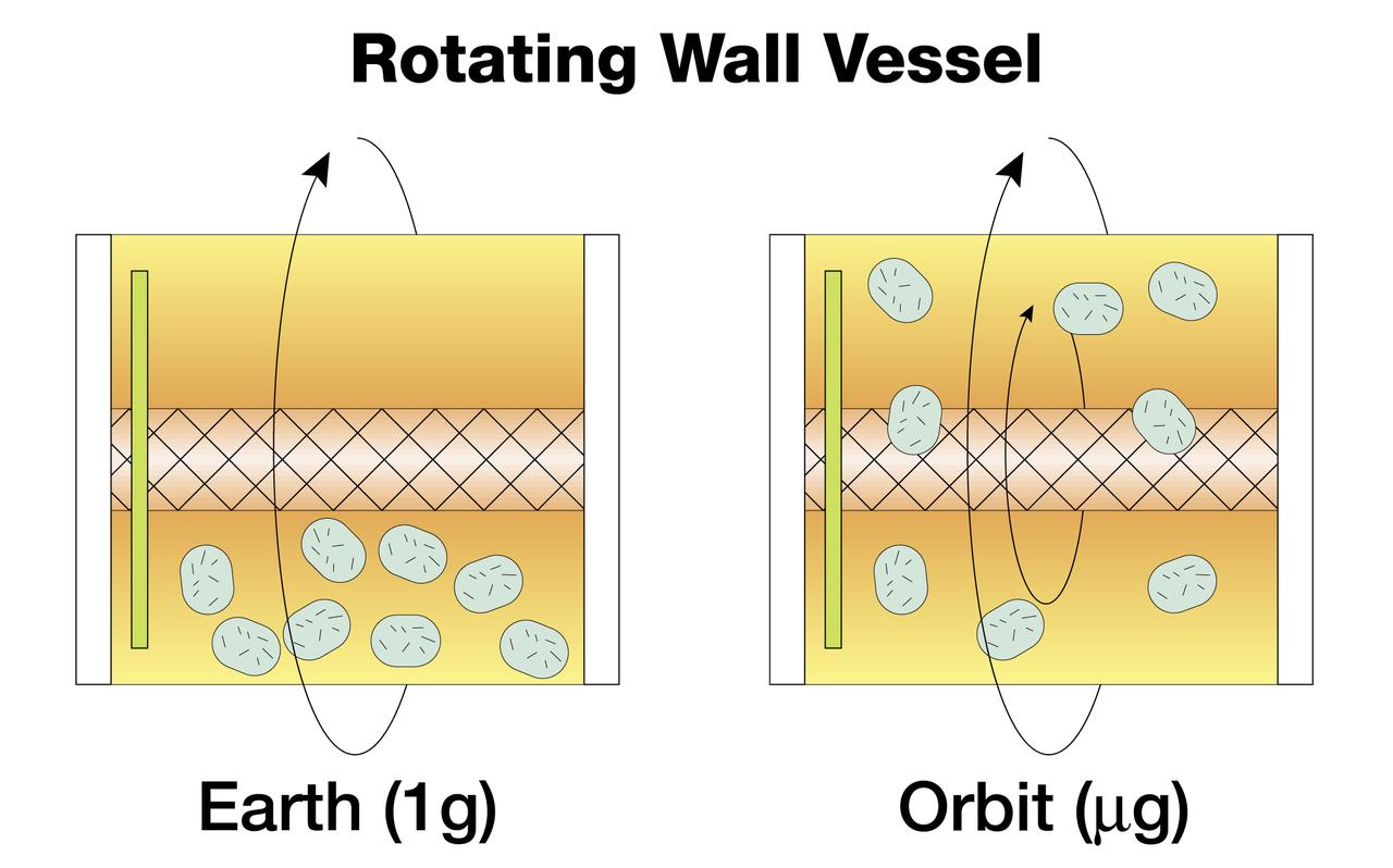 The NASA Bioreactor provides a low turbulence culture environment which promotes the formation of large, three-dimensional cell clusters. Due to their high level of cellular organization and specialization, samples constructed in the bioreactor more closely resemble the original tumor or tissue found in the body. The work is sponsored by NASA's Office of Biological and Physical Research. The bioreactor is managed by the Biotechnology Cell Science Program at NASA's Johnson Space Center (JSC). NASA-sponsored bioreactor research has been instrumental in helping scientists to better understand normal and cancerous tissue development. In cooperation with the medical community, the bioreactor design is being used to prepare better models of human colon, prostate, breast and ovarian tumors. Cartilage, bone marrow, heart muscle, skeletal muscle, pancreatic islet cells, liver and kidney are just a few of the normal tissues being cultured in rotating bioreactors by investigators. Cell constructs grown in a rotating bioreactor on Earth (left) eventually become too large to stay suspended in the nutrient media. In the microgravity of orbit, the cells stay suspended. Rotation then is needed for gentle stirring to replenish the media around the cells.