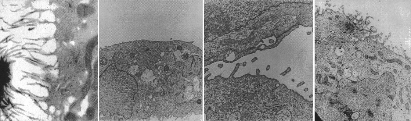 Cells from kidneys lose some of their special features in conventional culture but form spheres replete with specialized cell microvilli (hair) and synthesize hormones that may be clinically useful. Ground-based research studies have demonstrated that both normal and neoplastic cells and tissues recreate many of the characteristics in the NASA bioreactor that they display in vivo. Proximal kidney tubule cells that normally have rich apically oriented microvilli with intercellular clefts in the kidney do not form any of these structures in conventional two-dimensional monolayer culture. However, when normal proximal renal tubule cells are cultured in three-dimensions in the bioreactor, both the microvilli and the intercellular clefts form. This is important because, when the morphology is recreated, the function is more likely also to be rejuvenated. The work is sponsored by NASA's Office of Biological and Physical Research. The bioreactor is managed by the Biotechnology Cell Science Program at NASA's Johnson Space Center (JSC).