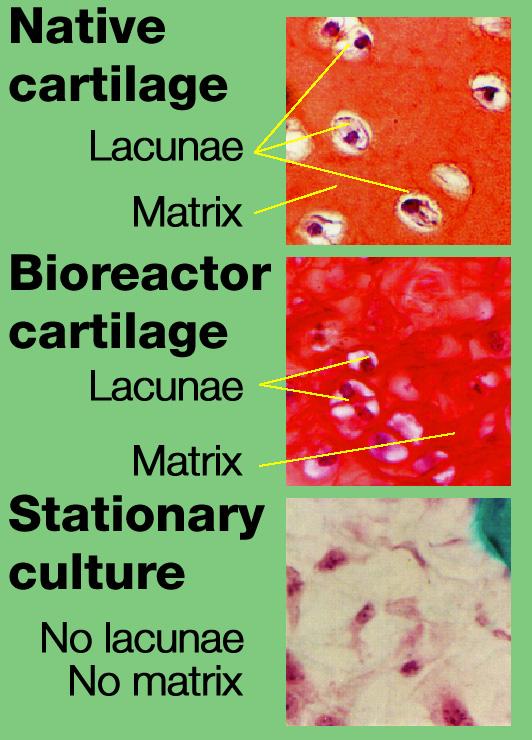 Dr. Lisa E. Freed of the Massachusetts Institute of Technology and her colleagues have reported that initially disc-like specimens tend to become spherical in space, demonstrating that tissues can grow and differentiate into distinct structures in microgravity. The Mir Increment 3 (Sept. 16, 1996 - Jan. 22, 1997) samples were smaller, more spherical, and mechanically weaker than Earth-grown control samples. These results demonstrate the feasibility of microgravity tissue engineering and may have implications for long human space voyages and for treating musculoskeletal disorders on earth. The work is sponsored by NASA's Office of Biological and Physical Research. The bioreactor is managed by the Biotechnology Cell Science Program at NASA's Johnson Space Center (JSC). NASA-sponsored bioreactor research has been instrumental in helping scientists to better understand normal and cancerous tissue development. In cooperation with the medical community, the bioreactor design is being used to prepare better models of human colon, prostate, breast and ovarian tumors. Cartilage, bone marrow, heart muscle, skeletal muscle, pancreatic islet cells, liver and kidney are just a few of the normal tissues being cultured in rotating bioreactors by investigators.