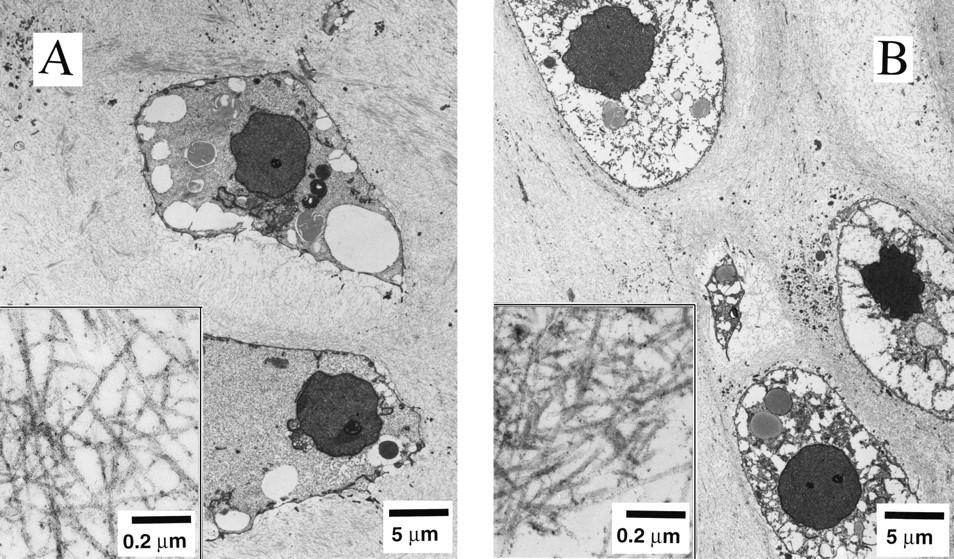 Dr. Lisa E. Freed of the Massachusetts Institute of Technology and her colleagues have reported that initially disc-like specimens tend to become spherical in space, demonstrating that tissues can grow and differentiate into distinct structures in microgravity. The Mir Increment 3 (Sept. 16, 1996 - Jan. 22, 1997) samples were smaller, more spherical, and mechanically weaker than Earth-grown control samples. These results demonstrate the feasibility of microgravity tissue engineering and may have implications for long human space voyages and for treating musculoskeletal disorders on earth. Final samples from Mir and Earth appeared histologically cartilaginous throughout their entire cross sections (5-8 mm thick), with the exception of fibrous outer capsules. Constructs grown on Earth (A) appeared to have a more organized extracellular matrix with more uniform collagen orientation as compared with constructs grown on Mir (B), but the average collagen fiber diameter was similar in the two groups (22 +- 2 nm) and comparable to that previously reported for developing articular cartilage. Randomly oriented collagen in Mir samples would be consistent with previous reports that microgravity disrupts fibrillogenesis. These are transmission electron micrographs of constructs from Mir (A) and Earth (B) groups at magnifications of x3,500 and x120,000 (Inset). The work is sponsored by NASA's Office of Biological and Physical Research. The bioreactor is managed by the Biotechnology Cell Science Program at NASA's Johnson Space Center (JSC). NASA-sponsored bioreactor research has been instrumental in helping scientists to better understand normal and cancerous tissue development. In cooperation with the medical community, the bioreactor design is being used to prepare better models of human colon, prostate, breast and ovarian tumors. Credit: Proceedings of the National Academy of Sciences.