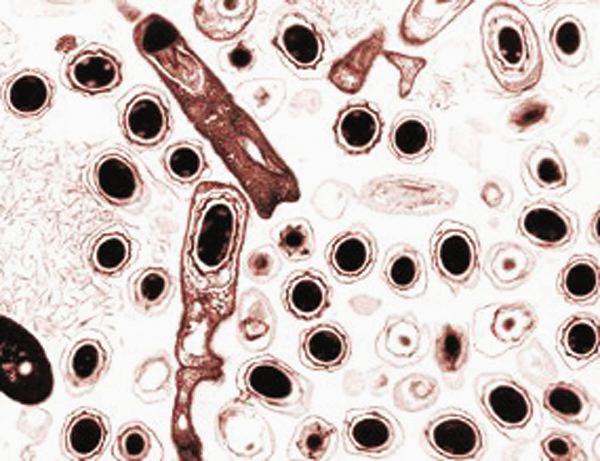 Anthrax spores are inactive forms of Bacillus anthracis. They can survive for decades inside a spore's tough protective coating; they become active when inhaled by humans. A result of NASA- and industry-sponsored research to develop small greenhouses for space research is the unique AiroCide TiO2 system that kills anthrax spores and other pathogens.