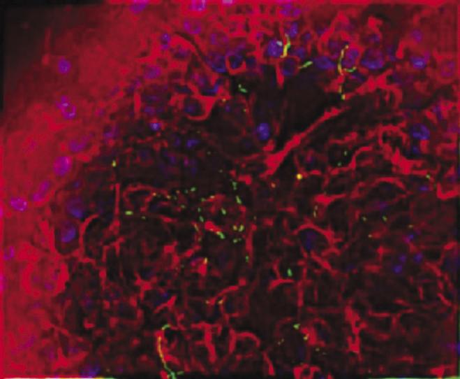 Salmonella typhimurium appears green in on human intestinal tissue (stained red) cultured in a NASA rotating wall bioreactor. Dr. Cheryl Nickerson of Tulane University is studying the effects of simulated low-g on a well-known pathogen, Salmonella typhimurium, a bacterium that causes two to four million cases of gastrointestinal illness in the United States each year. While most healthy people recover readily, S. typhimurium can kill people with weakened immune systems. Thus, a simple case of food poisoning could disrupt a space mission. Using the NASA rotating-wall bioreactor, Nickerson cultured S. typhimurium in modeled microgravity. Mice infected with the bacterium died an average of three days faster than the control mice, indicating that S. typhimurium's virulence was enhanced by the bioreactor. Earlier research showed that 3 percent of the genes were altered by exposure to the bioreactor. Nickerson's work earned her a 2001 Presidential Early Career Award for Scientists and Engineers.