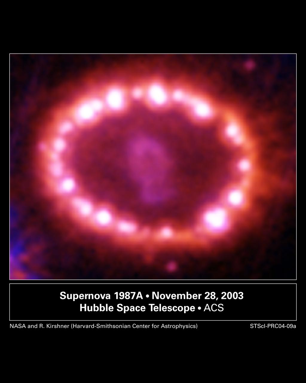 This image of SN 1987A, taken November 28, 2003 by the Advanced Camera for Surveys aboard NASA's Hubble Space Telescope (HST), shows many bright spots along a ring of gas, like pearls on a necklace. These cosmic pearls are being produced as superior shock waves unleashed during an explosion slam into the ring at more than a million miles per hour. The collision is heating the gas ring, causing its irnermost regions to glow. Astronomers detected the first of these hot spots in 1996, but now they see dozens of them all around the ring. With temperatures surging from a few thousand degrees to a million degrees, the flares are increasing in number. In the next few years, the entire ring will be ablaze as it absorbs the full force of the crash and is expected to become bright enough to illuminate the star's surroundings. Astronomers will then be able to obtain information on how the star ejected material before the explosion. The elongated and expanding object in the center of the ring is debris form the supernova blast which is being heated by radioactive elements, principally titanium 44, that were created in the explosion. This explosion was first observed by astronomers seventeen years ago in 1987, although the explosion took place about 160,000 years ago.