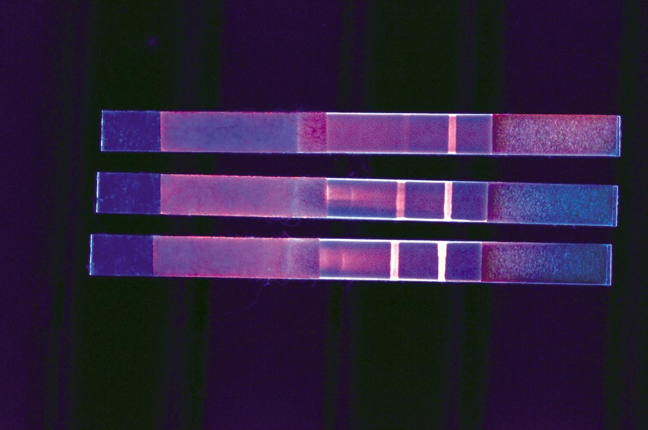 As easy to read as a home pregnancy test, three Quantifiable Lateral Flow Assay (QLFA) strips used to test water for E. coli show different results. The brightly glowing control line on the far right of each strip indicates that all three tests ran successfully. But the glowing test line on the middle left and bottom strips reveal their samples were contaminated with E. coli bacteria at two different concentrations. The color intensity correlates with concentration of contamination.