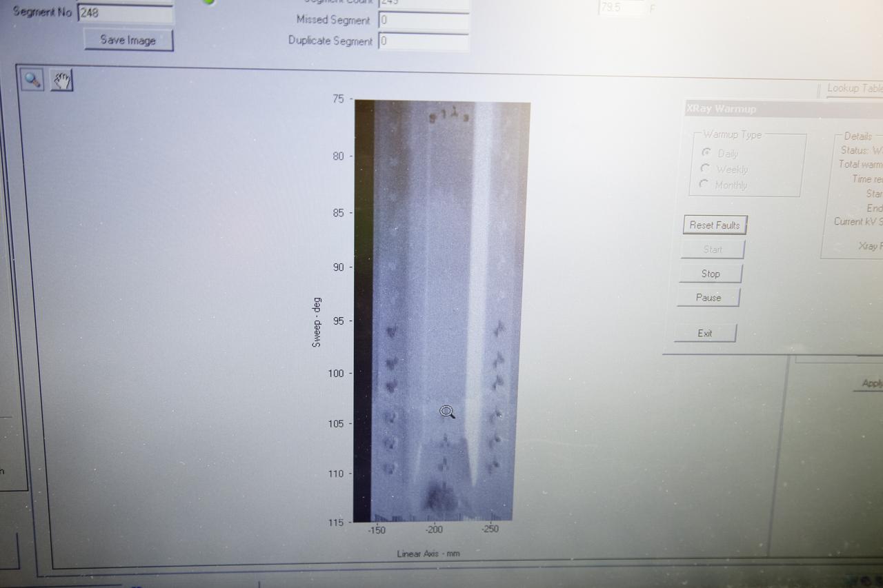 STS-133 DISCOVERY ET-137 X-RAY BACK SCATTER & SLIDE BASKET