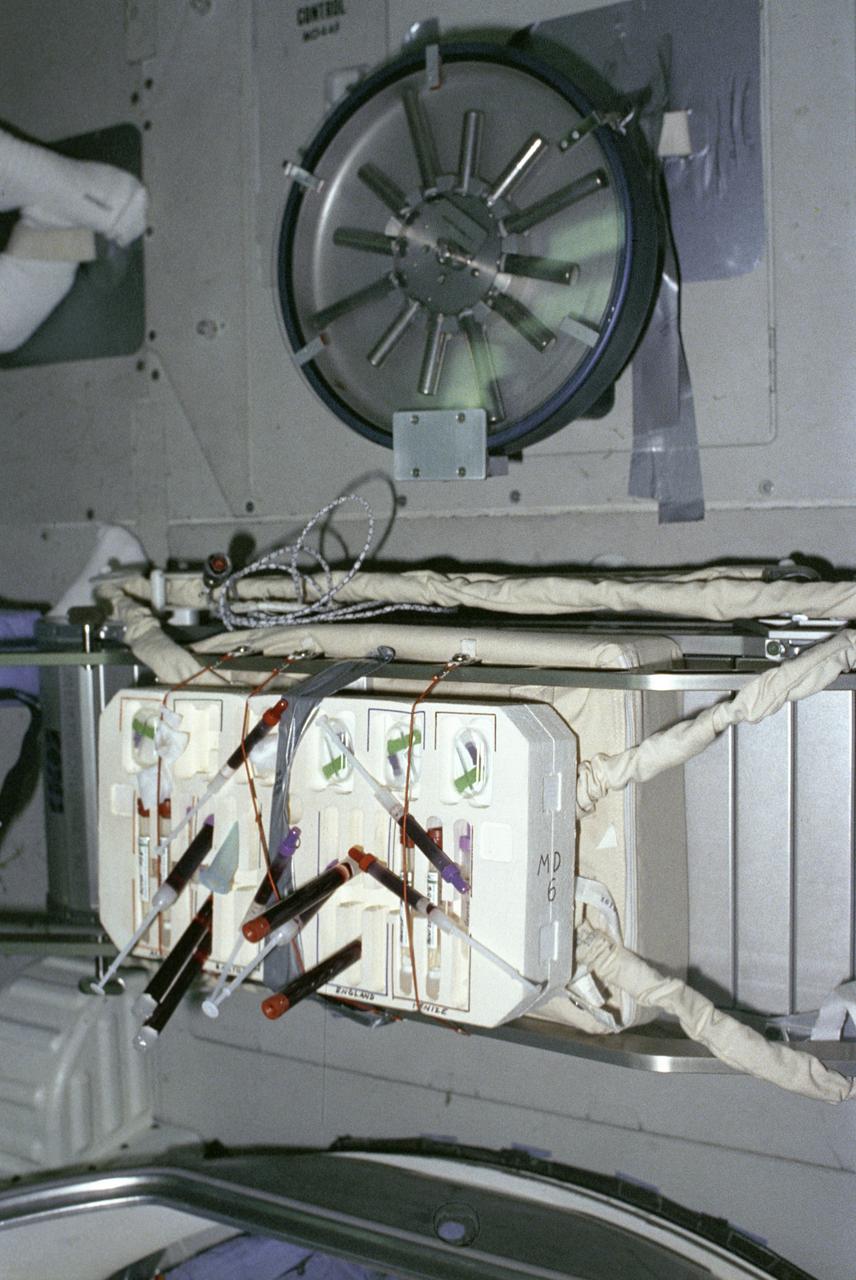 While instruments on the pallets in the payload bay observed the universe, biological experiments were performed in the middeck of the Shuttle Orbiter Challenger. Studying life processes in a microgravity environment can shed new light on the functioning of biological systems on Earth. These investigations can also help us understand how living organisms react to prolonged weightlessness. One such experiment was the vitamin D metabolites and bone demineralization experiment. This investigation measured the vitamin d metabolite levels of crew members to gain information on the cause of bone demineralization and mineral imbalance that occur during prolonged spaceflight as well as on Earth. Research into the biochemical nature of vitamin D has shown that the D-metabolites play a major role in regulating the body's calcium and phosphorus levels. One major function of the most biologically active vitamin D metabolite is to regulate the amount of calcium absorbed from the diet and taken out of bones. This investigation had two phases. The first was the developmental phase, which included extensive testing before flight, and the second, or final phase, involved the postflight analysis of the crew's blood samples. This photograph shows a blood draw test kit and centrifuge used for the experiment aboard the Spacelab-2. Marshall Space Flight Center had management responsibilities of all Spacelab missions.