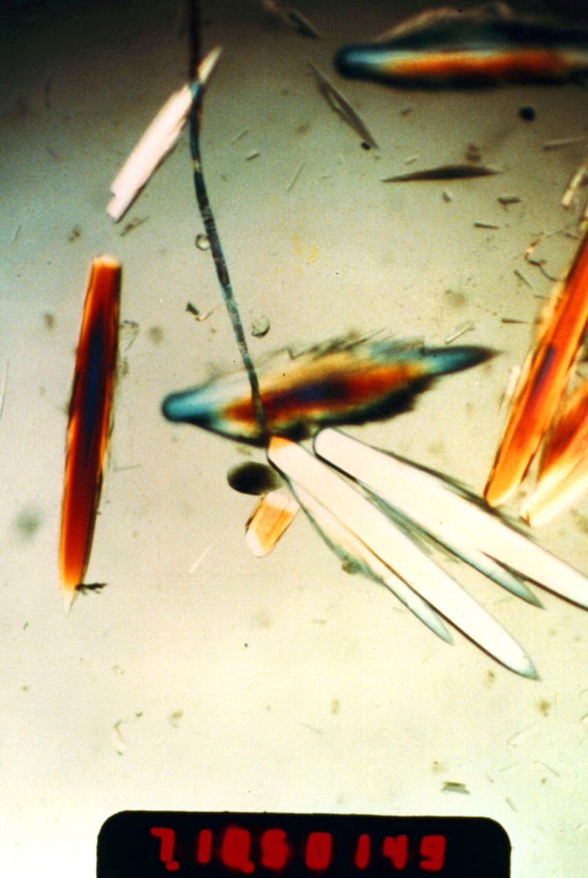 Horse Serum Albumin crystals grown during the USML-1 (STS-50) mission's Protein Crystal Growth Glovebox Experiment. These crystals were grown using a vapor diffusion technique at 22 degrees C. The crystals were allowed to grow for nine days while in orbit. Crystals of 1.0 mm in length were produced. The most abundant blood serum protein, regulates blood pressure and transports ions, metabolites, and therapeutic drugs. Principal Investigator was Edward Meehan.