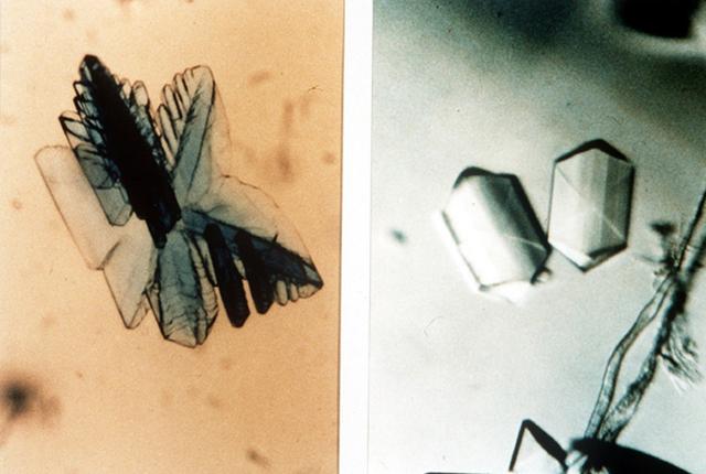 The comparison of protein crystal, Isocitrate Lyase earth-grown (left) and space-grown (right). This is a target enzyme for fungicides. A better understanding of this enzyme should lead to the discovery of more potent fungicides to treat serious crop diseases such as rice blast; it regulates the flow of metabolic intermediates required for cell growth. Principal Investigator is Larry DeLucas.