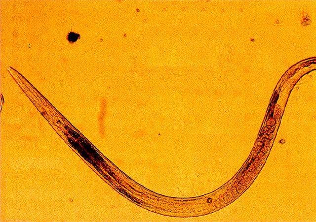 Over a billion of mostly third world people are infected with a roundworm known as ascarids. Ascarids are tiny parasites that infect the intestinal tract of vertebrates. Movement of the larvae into the brain or other parts of the body can prove fatal. Space-based research is providing new hope in combating these parasitic worms. Ascarids are dependent upon a substance known as malic enzyme to regulate certain bodily functions. A new drug designed to interfere with normal functioning of malic enzyme should prove deadly to ascarids. The Center for Macromolecular Crystallography, along with the University of North Texas grew malic enzyme crystals on the USML-1 Spacelab mission. Although these crystals proved to be smaller than ground based ones, they were more perfectly formed, therefore producing better data for drug design.