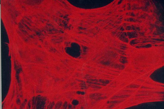 Biomedical research offers hope for a variety of medical problems, from diabetes to the replacement of damaged bone and tissues. Bioreactors, which are used to grow cells and tissue cultures, play a major role in such research and production efforts. Cell culturing, such as this bone cell culture, is an important part of biomedical research. The BioDyn payload includes a tissue engineering investigation. The commercial affiliate, Millenium Biologix, Inc., has been conducting bone implant experiments to better understand how synthetic bone can be used to treat bone-related illnesses and bone damaged in accidents. On STS-95, the BioDyn payload will include a bone cell culture aimed to help develop this commercial synthetic bone product. Millenium Biologix, Inc., is exploring the potential for making human bone implantable materials by seeding its proprietary artificial scaffold material with human bone cells. The product of this tissue engineering experiment using the Bioprocessing Modules (BPMs) on STS-95 is space-grown bone implants, which could have potential for dental implants, long bone grafts, and coating for orthopedic implants such as hip replacements.