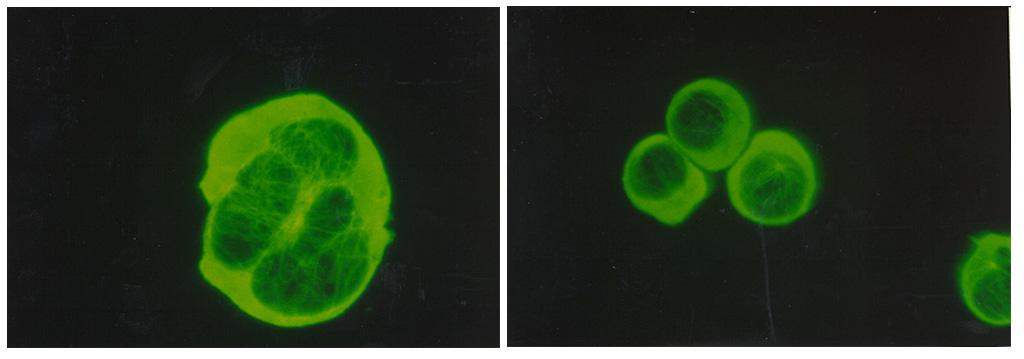 Biomedical research offers hope for a variety of medical problems, from diabetes to the replacement of damaged bone and tissues. Bioreactors, which are used to grow cells and tissue cultures, play a major role in such research and production efforts. The objective of the research was to define a way to differentiate between effects due to microgravity and those due to possible stress from non-optimal spaceflight conditions. These Jurkat cells, a human acute T-cell leukemia was obtained to evaluate three types of potential experimental stressors: a) Temperature elevation; b) Serum starvation; and c) Centrifugal force. The data from previous spaceflight experiments showed that actin filaments and cell shape are significantly different for the control. These normal cells serve as the baseline for future spaceflight experiments. 