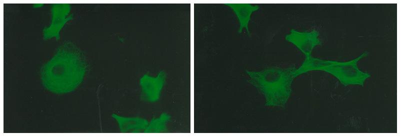 Biomedical research offers hope for a variety of medical problems, from diabetes to the replacement of damaged bone and tissues. Bioreactors, which are used to grow cells and tissue cultures, play a major role in such research and production efforts. Cell culturing, such as this bone cell culture, is an important part of biomedical research. The BioDyn payload includes a tissue engineering investigation. The commercial affiliate, Millenium Biologix, Inc. has been conducting bone implant experiments to better understand how synthetic bone can be used to treat bone-related illnesses and bone damaged in accidents. On STS-95, the BioDyn payload will include a bone cell culture aimed to help develop this commercial synthetic bone product. Millenium Biologix, Inc. is exploring the potential for making human bone implantable materials by seeding its proprietary artificial scaffold material with human bone cells. The product of this tissue engineering experiment using the Bioprocessing Modules (BPMs) on STS-95 is space-grown bone implants, which could have potential for dental implants, long bone grafts, and coating for orthopedic implants such as hip replacements.