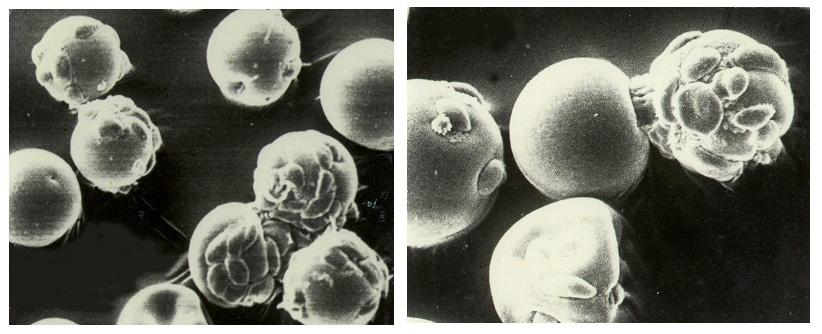 Biomedical research offers hope for a variety of medical problems, from diabetes to the replacement of damaged bone and tissues. Bioreactors, which are used to grow cells and tissue cultures, play a major role in such research and production efforts. Anchorage dependent cells on STS-95 will be grown on beads similar to these cells produced during previous investigations. Recombinant proteins may offer the possibility of reducing or eliminating transplant rejections. Research by Synthecon, Inc. using the BioDyn Bioreactor will focus on the preliminary process for growing a proprietary recombinant protein that can decrease rejection of transplanted tissue. The cells producing this protein are anchorage dependent, meaning that they must attach to something to grow. These cells will be cultured in the bioreactor in a medium containing polymer microbeads. Synthecon hopes that the data from this mission will lead to the development of a commercial protein that will aid in prevention of transplant rejection.