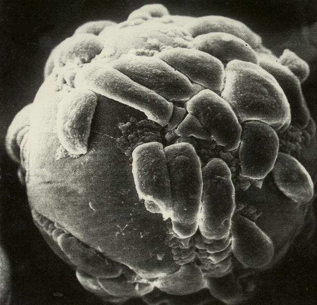 Biomedical research offers hope for a variety of medical problems, from diabetes to the replacement of damaged bone and tissues. Bioreactors, which are used to grow cells and tissue cultures, play a major role in such research and production efforts. Anchorage dependent cells on STS-95 will be grown on beads, similar to these cells produced during previous investigations. Recombinant proteins may offer the possibility of reducing or eliminating transplant rejections. Research by Synthecon, Inc. using the BioDyn Bioreactor will focus on the preliminary process for growing a proprietary recombinant protein that can decrease rejection of transplanted tissue. The cells producing this protein are anchorage dependent, meaning that they must attach to something to grow. These cells will be cultured in the bioreactor in a medium containing polymer microbeads. Synthecon hopes that the data from this mission will lead to the development of a commercial protein that will aid in prevention of transplant rejection.