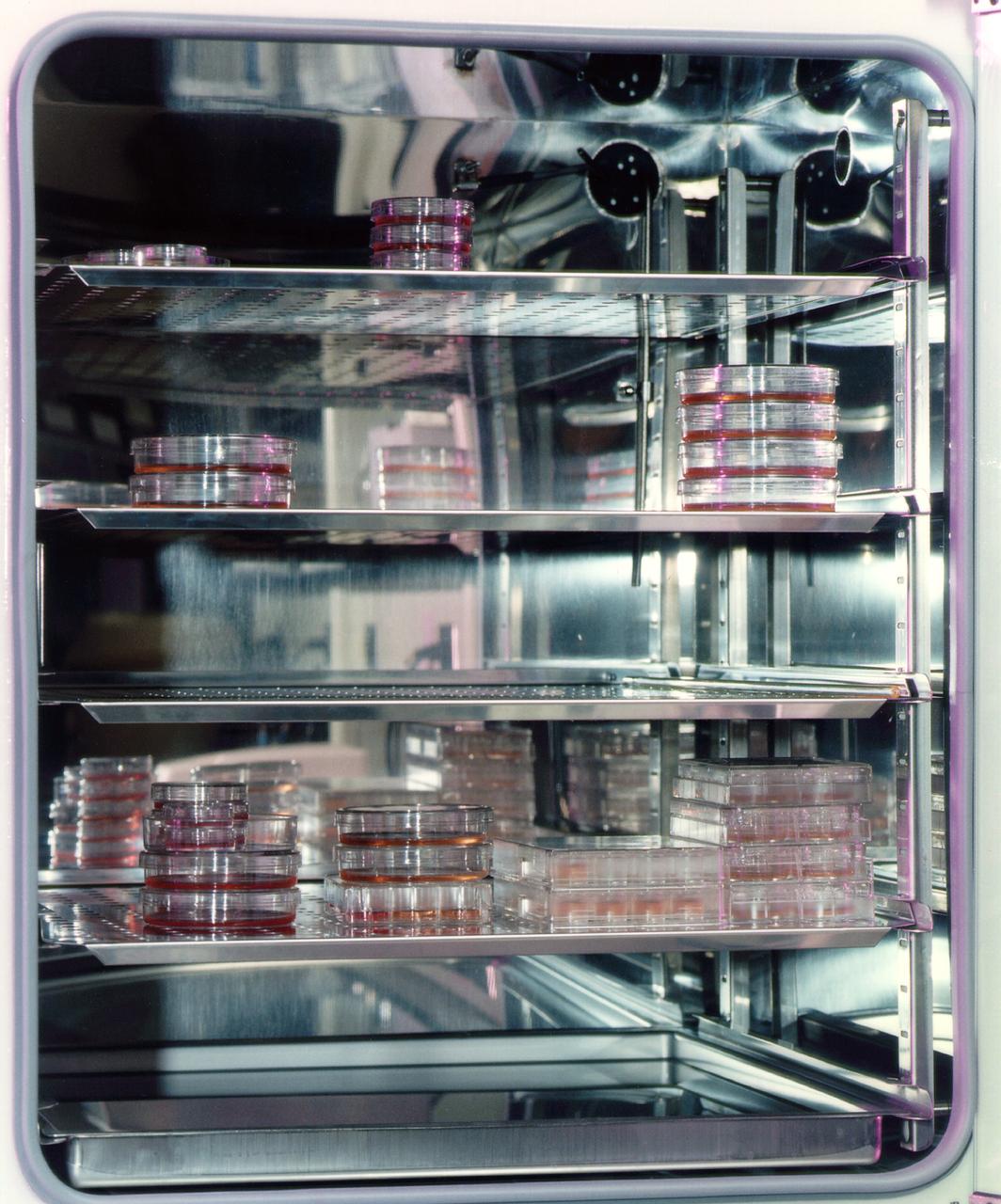 Breast tissue specimens in traditional sample dishes. NASA's Marshall Space Flight Center (MSFC) is sponsoring research with Bioreactors, rotating wall vessels designed to grow tissue samples in space, to understand how breast cancer works. This ground-based work studies the growth and assembly of human mammary epithelial cells (HMEC) from breast cancer susceptible tissue. Radiation can make the cells cancerous, thus allowing better comparisons of healthy vs. tunourous tissues. 
