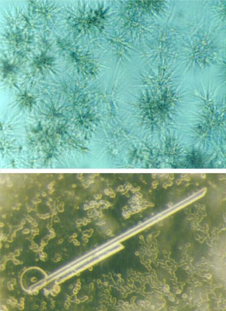 This image shows crystals of the protein raf kinase grown on Earth (photo a) and on USML-2 (photo b). The space-grown crystals are an order of magnitude larger. Principal Investigator: Dan Carter of New Century Pharmaceuticals