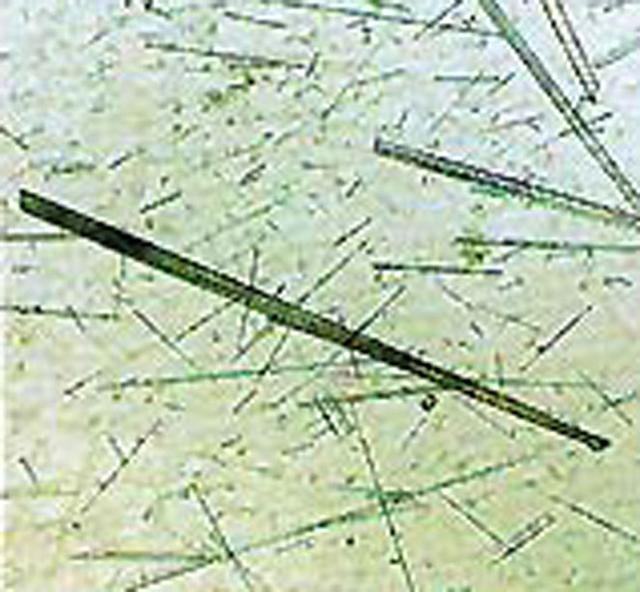 This is a enzyme, plant chitinase, believed to be a defensive enzyme to discourage invasion of plant tissue by insects.