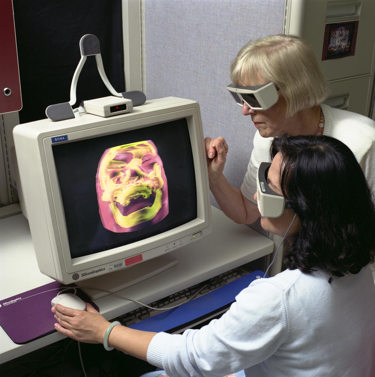 Virtual Environment for (facial) ) reconstructive surgery, Dr Ross and Rei Cheng work with the 3d glasses as they maneuver the skull and tissue for the facial reconstructive surgery
