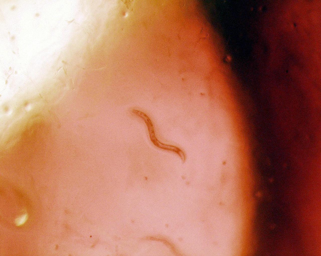 KENNEDY SPACE CENTER, FLA. - C. elegans nemotodes (round worms) undergo examination by project scientists. These specimens were found in a Biological Research in Canisters (BRIC) container, a middeck experiment that was among the Columbia debris recovered in East Texas. The worms are descendants of those that were part of an experiment that flew on Columbia's last mission, STS-107. The experiment was designed to verify a new synthetic nutrient solution for an International Space Station (ISS) "model" specimen planned to be used extensively for ISS gene expression studies and was sponsored by the NASA Ames Research Center. Scientists are now looking over the experiment at KSC to determine if it will yield any scientific results. The investigation into the cause of the Columbia accident is ongoing. (Photo Credit: Volker Kern, NASA Ames Research Center)