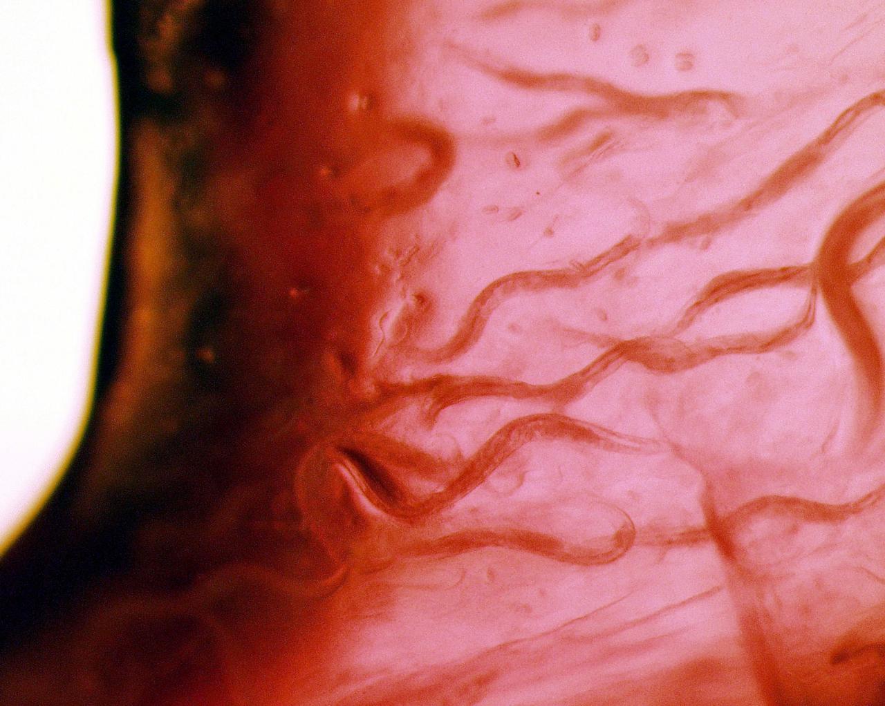 KENNEDY SPACE CENTER, FLA. - C. elegans nemotodes (round worms) undergo examination by project scientists. These specimens were found in a Biological Research in Canisters (BRIC) container, a middeck experiment that was among the Columbia debris recovered in East Texas. The worms are descendants of those that were part of an experiment that flew on Columbia's last mission, STS-107. The experiment was designed to verify a new synthetic nutrient solution for an International Space Station (ISS) "model" specimen planned to be used extensively for ISS gene expression studies and was sponsored by the NASA Ames Research Center. Scientists are now looking over the experiment at KSC to determine if it will yield any scientific results. The investigation into the cause of the Columbia accident is ongoing. (Photo Credit: Volker Kern, NASA Ames Research Center)