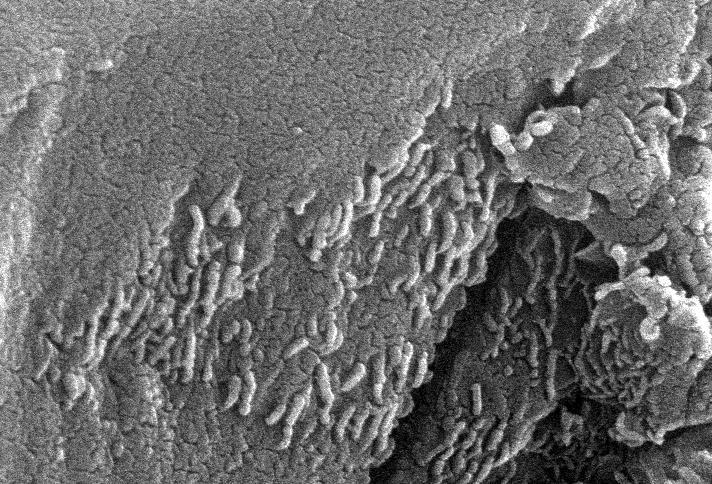 This electron microscope image is a close-up of the center part of photo number S96-12301.  http://photojournal.jpl.nasa.gov/catalog/PIA00284
