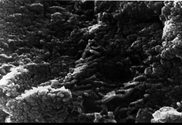 This electron microscope image shows tubular structures of likely Martian origin. These structures are very similar in size and shape to extremely tiny microfossils found in some Earth rocks.  http://photojournal.jpl.nasa.gov/catalog/PIA00287