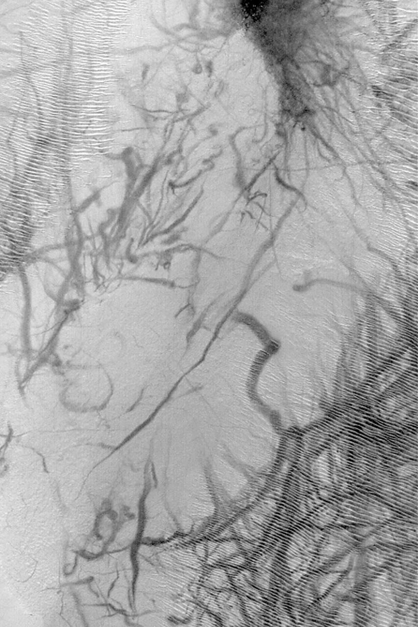 Argyre Dust Devil Tracks