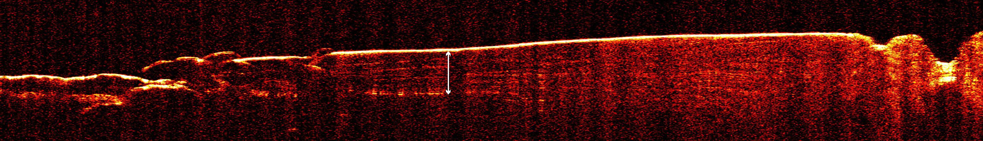 Radar View of Layering near Mars South Pole, Orbit 1360