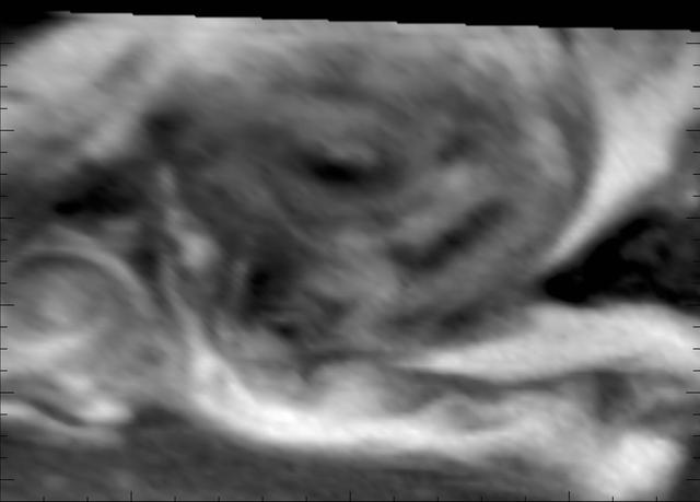 NASA image: Swirling Vortex