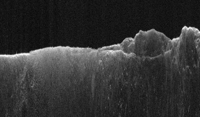 This radargram shows data collected by the Shallow Radar, or SHARAD, on NASA's Mars Reconnaissance Orbiter (MRO) on May 2, 2023, as it performed a 120-degree roll maneuver called a "very large roll" over a formation named Medusae Fossae. Scientists used SHARAD to look for ice beneath the surface of this region.  Designed to peer from about a half-mile to a little over a mile (1 to 2 kilometers) below ground, SHARAD emits radio waves that are reflected off materials in the subsurface, measuring how long it takes for those waves to bounce back to the instrument. The longer it takes, the deeper the subsurface layer is. Because different materials reflect radio waves differently, SHARAD allows scientists to distinguish between rock, sand, and ice.  While MRO often performs a standard 28-degree roll to give SHARAD's antenna a more direct view of Martian terrain, the 120-degree very large roll rotates the antenna even farther, providing its radio waves an unobstructed path to the surface. This boosts the radar's signals by 10 times or more, giving SHARAD a clearer, deeper view of the Martian underground than ever before. Scientists hope the very large rolls will help them look for frozen and liquid water, among other things.  https://photojournal.jpl.nasa.gov/catalog/PIA26555