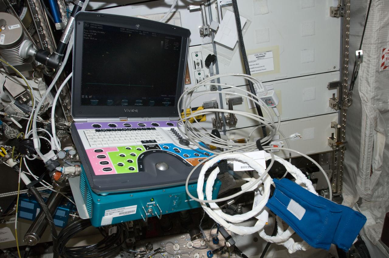 View of Integrated Cardiovascular (ICV) Echo Ultrasound Scan,in the Columbus module.  ICV aims to quantify the extent,time course and clinical significance of cardiac atrophy (decrease in the size of the heart muscle) in space.  Photo was taken during Expedition 34.