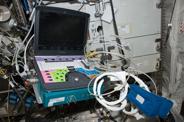 NASA image: ICV Echo Ultrasound Scan