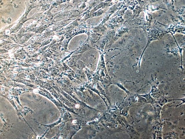 NASA image: Skeletal muscle cells cultured on Earth