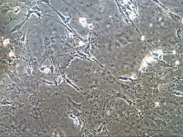 NASA image: Skeletal muscle cells cultured in space