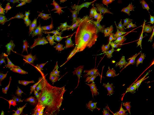 jsc2019e039830 (6/25/2019) --- A preflight photo taken as part of Nano Antioxidants experiment. C2C12 skeletal muscle cells grown in laboratory on Earth. Confocal microscopy image showing cytoskeletal actin in red, vinculin in green, and cell nuclei in blue. The experiment aims at elaborating antioxidant nanoparticle-based countermeasures to skeletal muscle loss occurring both in space and on Earth, in order to enable long-term human exploration of space and therapy of musculodegenerative diseases. Nanoparticles under study are composed of cerium oxide, that mimics natural defense against oxidative stress and shows long-lasting antioxidant effects. The aim of the Nano Antioxidants investigation is to research innovative approaches for cellular stimulation to counteract the negative effects of long-term microgravity on the musculoskeletal system. (Image courtesy of  Dr. Gianni Ciofani, IIT and PoliTo)
