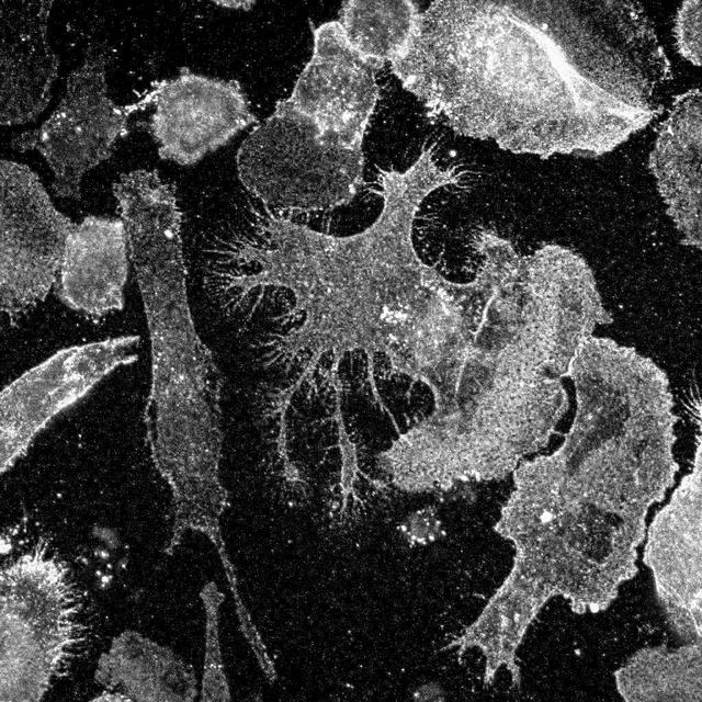 NASA image: Microglia cells growing in a culture dish (63x magnification)