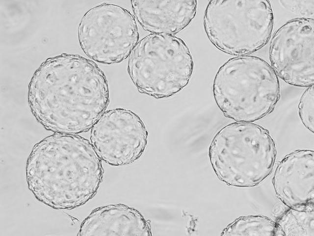 jsc2019e041776 (10/2/2012) --- A preflight phase contrast image of vascular endothelial cells cultured on microcarrier beads before being put into the flight hardware. Used for STaARS BioScience-3 experiment. The Spaceflight Effects on Vascular Endothelial and Smooth Muscle Cell Process (STaARS BioScience-3) investigation contributes to a greater understanding of cardiovascular disease (CVD) through the study of transcriptomics of vascular cells. Upon return from spaceflight, crew members often display alterations in their cardiovascular systems, similar to those suffering from CVD. The goal of this work is to elucidate the mechanism of vascular cell damage in the space environment by exposing vascular cells to spaceflight.