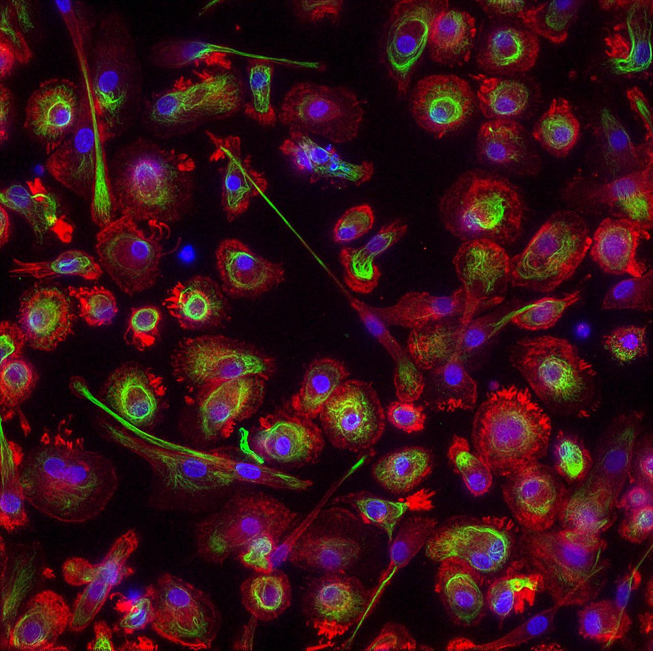 jsc2019e051831 --- Image of fixed macrophages using three chromophores created by the FLUMIAS-DEA miniaturized fluorescence microscope during Science Verification Test. Image courtesy of: Airbus